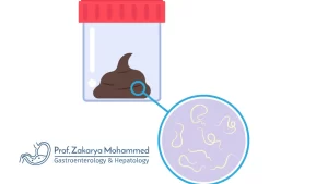 هل تخرج جرثومة المعدة مع البراز