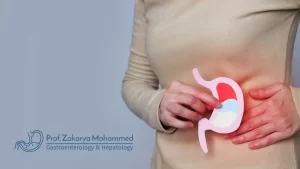 كم يستغرق علاج قرحة المعدة