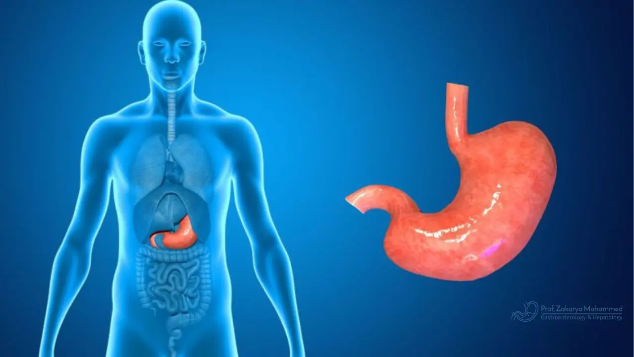 أعراض التهاب المعدة والقولون