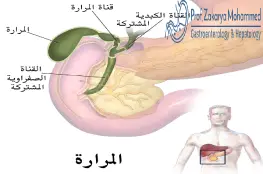 أعراض انسداد القناة المرارية،