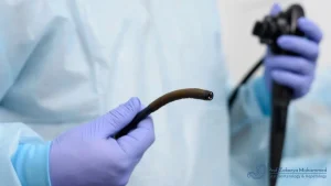 جرثومة المعدة بالمنظار​