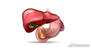 أعراض المرارة المبكرة
