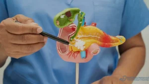 افضل دكتور لعلاج المرارة في مصر