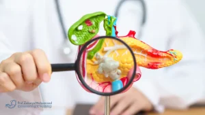 أفضل دكتور لعلاج التهاب البنكرياس